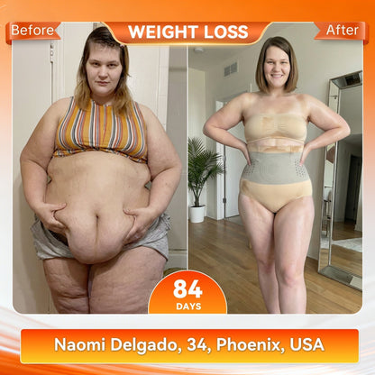 𝐎𝐟𝐟𝐢𝐜𝐢𝐚𝐥 𝐁𝐫𝐚𝐧𝐝 𝐒𝐭𝐨𝐫𝐞 🛒 𝑨𝑳𝑳𝒀𝑩𝑬𝑬® 𝟐𝟎𝟐𝟔 𝐌𝐨𝐫𝐢𝐧𝐠𝐚 & 𝐁𝐞𝐫𝐛𝐞𝐫𝐢𝐧𝐞 𝟒-𝐈𝐧-𝟏 𝐌𝐢𝐜𝐫𝐨-𝐏𝐚𝐫𝐭𝐢𝐜𝐥𝐞 𝐒𝐜𝐮𝐥𝐩𝐭𝐢𝐧𝐠 & 𝐅𝐚𝐭-𝐁𝐮𝐫𝐧 𝐒𝐡𝐨𝐫𝐭𝐬