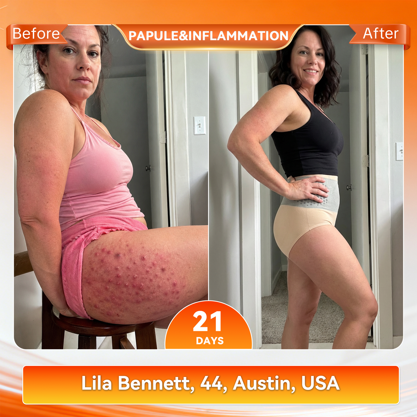 𝐎𝐟𝐟𝐢𝐜𝐢𝐚𝐥 𝐁𝐫𝐚𝐧𝐝 𝐒𝐭𝐨𝐫𝐞 🛒 𝑨𝑳𝑳𝒀𝑩𝑬𝑬® 𝟐𝟎𝟐𝟔 𝐌𝐨𝐫𝐢𝐧𝐠𝐚 & 𝐁𝐞𝐫𝐛𝐞𝐫𝐢𝐧𝐞 𝟒-𝐈𝐧-𝟏 𝐌𝐢𝐜𝐫𝐨-𝐏𝐚𝐫𝐭𝐢𝐜𝐥𝐞 𝐒𝐜𝐮𝐥𝐩𝐭𝐢𝐧𝐠 & 𝐅𝐚𝐭-𝐁𝐮𝐫𝐧 𝐒𝐡𝐨𝐫𝐭𝐬