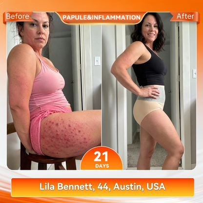 𝐎𝐟𝐟𝐢𝐜𝐢𝐚𝐥 𝐁𝐫𝐚𝐧𝐝 𝐒𝐭𝐨𝐫𝐞 🛒 𝑨𝑳𝑳𝒀𝑩𝑬𝑬® 𝟐𝟎𝟐𝟔 𝐌𝐨𝐫𝐢𝐧𝐠𝐚 & 𝐁𝐞𝐫𝐛𝐞𝐫𝐢𝐧𝐞 𝟒-𝐈𝐧-𝟏 𝐌𝐢𝐜𝐫𝐨-𝐏𝐚𝐫𝐭𝐢𝐜𝐥𝐞 𝐒𝐜𝐮𝐥𝐩𝐭𝐢𝐧𝐠 & 𝐅𝐚𝐭-𝐁𝐮𝐫𝐧 𝐒𝐡𝐨𝐫𝐭𝐬