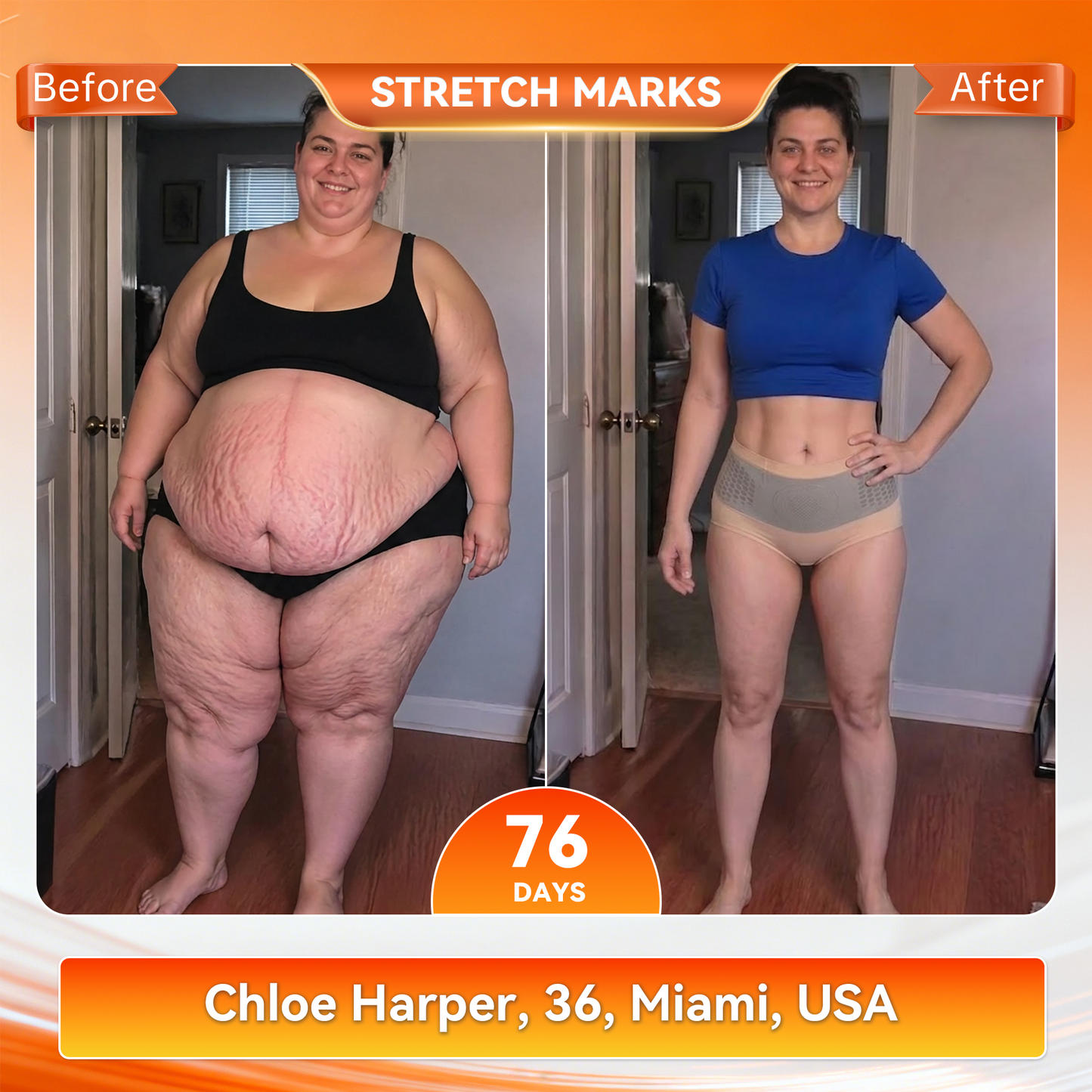 𝐎𝐟𝐟𝐢𝐜𝐢𝐚𝐥 𝐁𝐫𝐚𝐧𝐝 𝐒𝐭𝐨𝐫𝐞 🛒 𝑨𝑳𝑳𝒀𝑩𝑬𝑬® 𝟐𝟎𝟐𝟔 𝐌𝐨𝐫𝐢𝐧𝐠𝐚 & 𝐁𝐞𝐫𝐛𝐞𝐫𝐢𝐧𝐞 𝟒-𝐈𝐧-𝟏 𝐌𝐢𝐜𝐫𝐨-𝐏𝐚𝐫𝐭𝐢𝐜𝐥𝐞 𝐒𝐜𝐮𝐥𝐩𝐭𝐢𝐧𝐠 & 𝐅𝐚𝐭-𝐁𝐮𝐫𝐧 𝐒𝐡𝐨𝐫𝐭𝐬