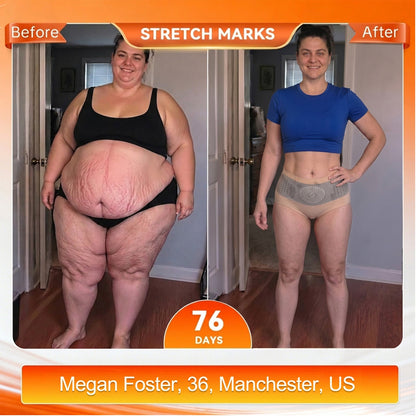 𝐎𝐟𝐟𝐢𝐜𝐢𝐚𝐥 𝐁𝐫𝐚𝐧𝐝 𝐒𝐭𝐨𝐫𝐞 🌟 𝑨𝑳𝑳𝒀𝑩𝑬𝑬® 𝟐𝟎𝟐𝟔 𝐌𝐨𝐫𝐢𝐧𝐠𝐚 & 𝐁𝐞𝐫𝐛𝐞𝐫𝐢𝐧𝐞 𝟒-𝐈𝐧-𝟏 𝐌𝐢𝐜𝐫𝐨-𝐏𝐚𝐫𝐭𝐢𝐜𝐥𝐞 𝐒𝐜𝐮𝐥𝐩𝐭𝐢𝐧𝐠 & 𝐅𝐚𝐭-𝐁𝐮𝐫𝐧 𝐒𝐡𝐨𝐫𝐭𝐬